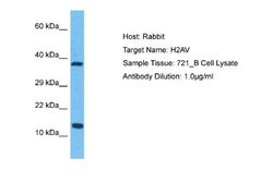 H2AFV Rabbit anti-Human, Polyclonal, Novus Biologicals 0.1ml; Unconjugated:Antibodies,